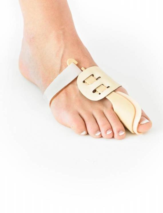 bunion night splint