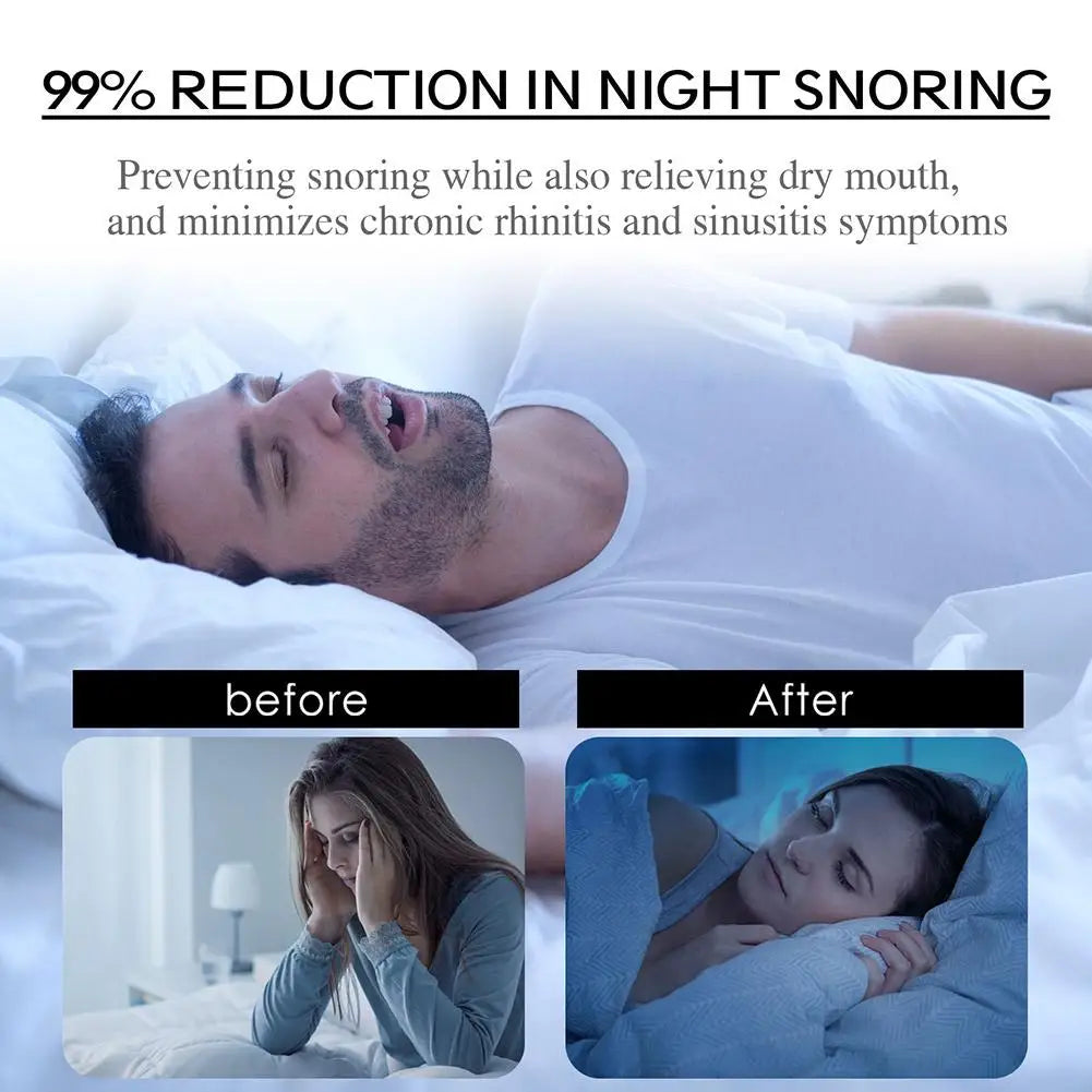 Stop Snoring Mouth Tape – 30 Patches